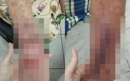 Idosa é agredida com tamanco durante briga entre moradores em condomínio de Aparecida