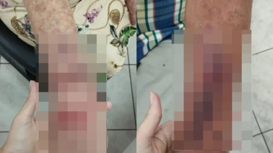 Idosa é agredida com tamanco durante briga entre moradores em condomínio de Aparecida