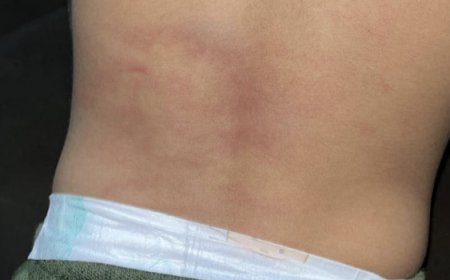 Lesão em criança de 3 anos é constatada por exame médico após agressão em Carmo do Rio Verde, suspeito foi preso