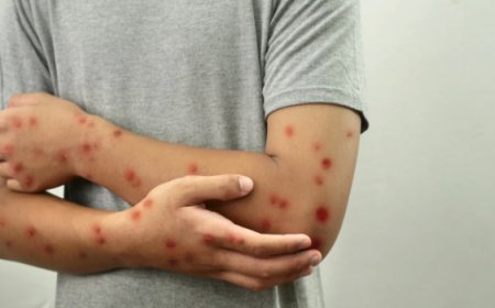 Exame descarta caso suspeito de Mpox em Goianésia, informa Secretaria de Saúde; veja nota oficial