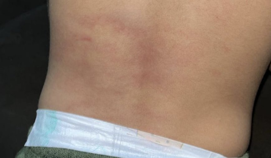 Lesão em criança de 3 anos é constatada por exame médico após agressão em Carmo do Rio Verde, suspeito foi preso