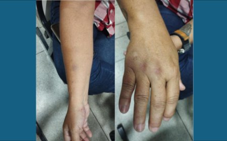 Filho agride mãe com capacete e foge ao ver a polícia em Ceres