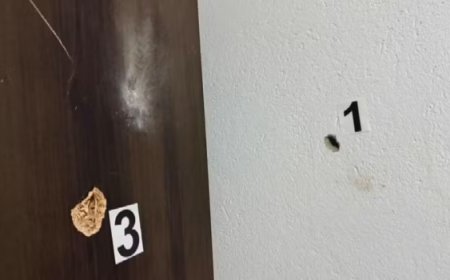 Criança de 7 anos leva tiro no rosto após arma do padrasto disparar em Uruaçu